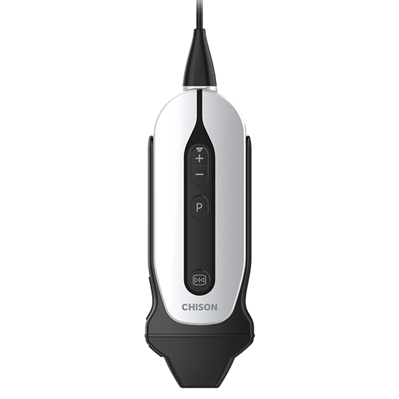 SonoEye P3